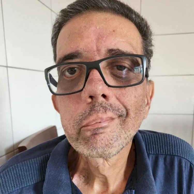Ajude JULIO GOMES a continuar seu tratamento contra o câncer
