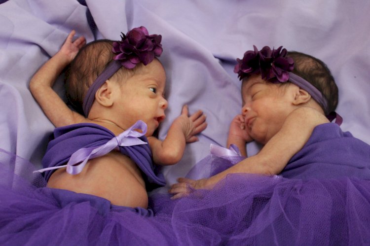 Hospital Estadual da Criança celebra a força dos prematuros com ensaio fotográfico no Novembro Roxo